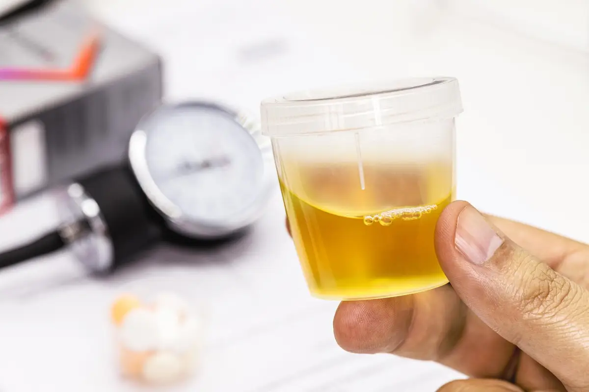 urine transparente verre, hydratation reins, diabète soif